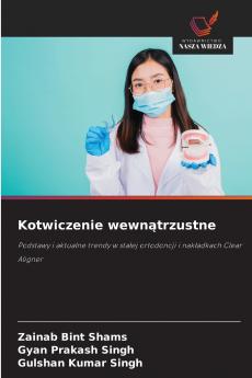 Kotwiczenie wewnątrzustne