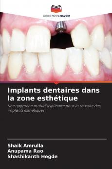 Implants dentaires dans la zone esthétique