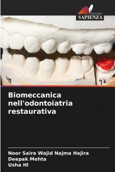 Biomeccanica nell'odontoiatria restaurativa