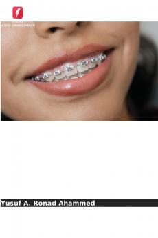 Avanços nos materiais ortodônticos