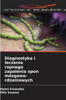 Diagnostyka i leczenie ropnego zapalenia opon mózgowo-rdzeniowych