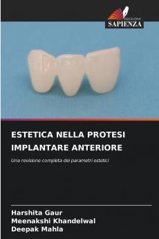 ESTETICA NELLA PROTESI IMPLANTARE ANTERIORE