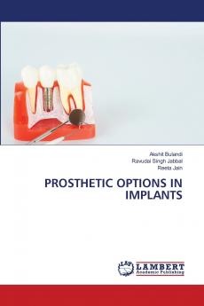 PROSTHETIC OPTIONS IN IMPLANTS