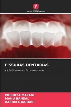 FISSURAS DENTÁRIAS