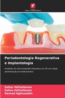 Periodontologia Regenerativa e Implantologia