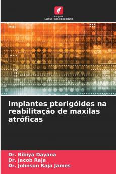 Implantes pterigóides na reabilitação de maxilas atróficas