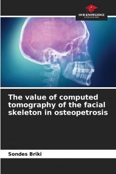 The value of computed tomography of the facial skeleton in osteopetrosis