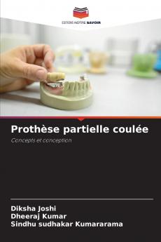 Prothèse partielle coulée