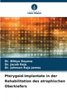 Pterygoid-Implantate in der Rehabilitation des atrophischen Oberkiefers