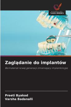Zaglądanie do implantów