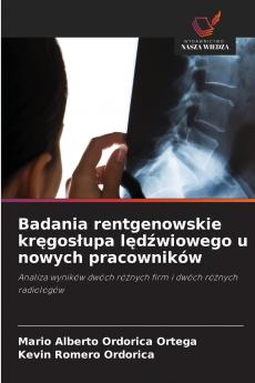 Badania rentgenowskie kręgosłupa lędźwiowego u nowych pracowników