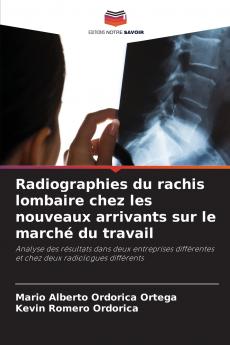 Radiographies du rachis lombaire chez les nouveaux arrivants sur le marché du travail