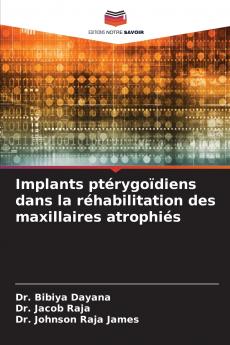 Implants ptérygoïdiens dans la réhabilitation des maxillaires atrophiés