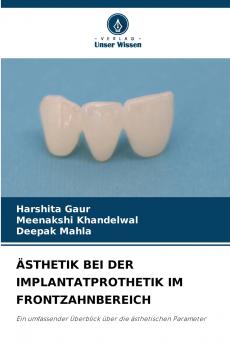 ÄSTHETIK BEI DER IMPLANTATPROTHETIK IM FRONTZAHNBEREICH