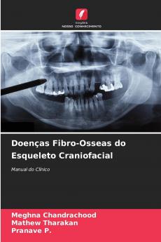 Doenças Fibro-Osseas do Esqueleto Craniofacial