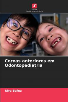 Coroas anteriores em Odontopediatria
