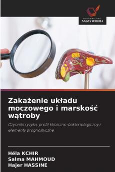 Zakażenie układu moczowego i marskość wątroby