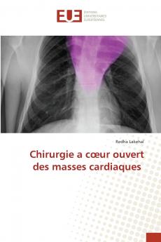 Chirurgie a cœur ouvert des masses cardiaques