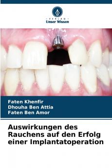 Auswirkungen des Rauchens auf den Erfolg einer Implantatoperation