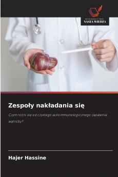 Zespoły nakładania się