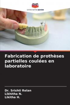 Fabrication de prothèses partielles coulées en laboratoire
