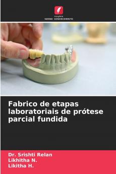 Fabrico de etapas laboratoriais de prótese parcial fundida