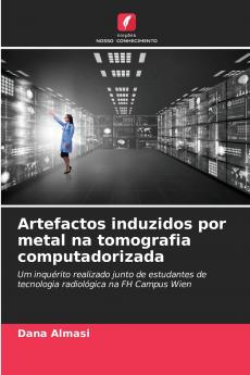 Artefactos induzidos por metal na tomografia computadorizada