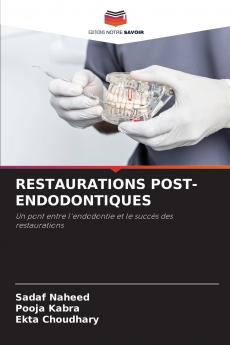 RESTAURATIONS POST-ENDODONTIQUES
