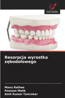 Resorpcja wyrostka zębodołowego