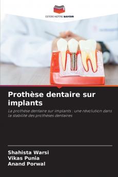 Prothèse dentaire sur implants
