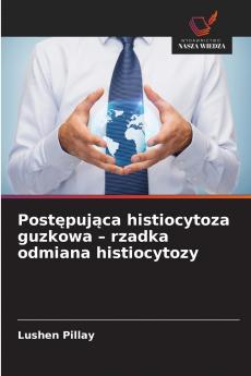Postępująca histiocytoza guzkowa - rzadka odmiana histiocytozy