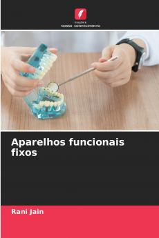 Aparelhos funcionais fixos