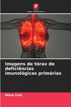 Imagens de tórax de deficiências imunológicas primárias