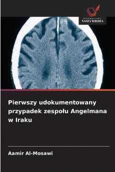 Pierwszy udokumentowany przypadek zespołu Angelmana w Iraku