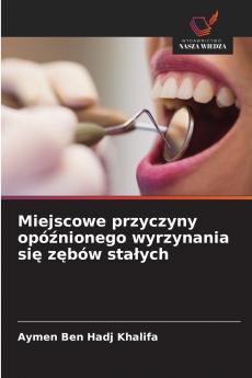 Miejscowe przyczyny opóźnionego wyrzynania się zębów stałych