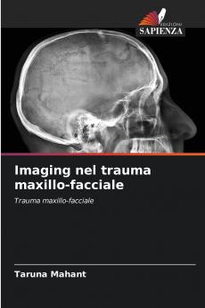 Imaging nel trauma maxillo-facciale