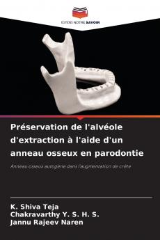 Préservation de l'alvéole d'extraction à l'aide d'un anneau osseux en parodontie