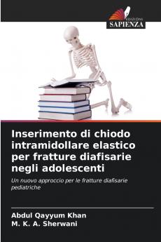 Inserimento di chiodo intramidollare elastico per fratture diafisarie negli adolescenti