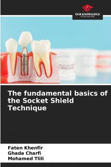 The fundamental basics of the Socket Shield Technique