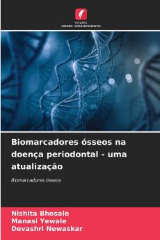 Biomarcadores ósseos na doença periodontal - uma atualização