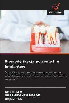 Biomodyfikacja powierzchni implantów