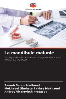 La mandibule malunie