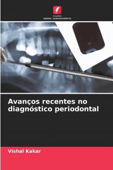 Avanços recentes no diagnóstico periodontal