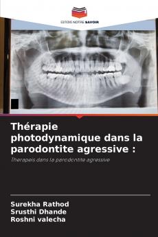Thérapie photodynamique dans la parodontite agressive