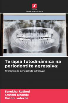 Terapia fotodinâmica na periodontite agressiva
