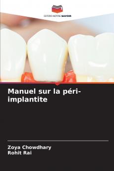 Manuel sur la péri-implantite