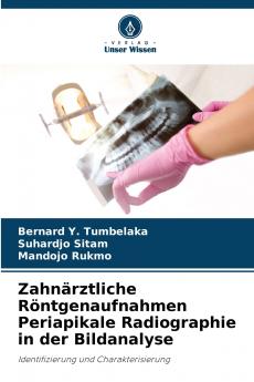 Zahnärztliche Röntgenaufnahmen Periapikale Radiographie in der Bildanalyse