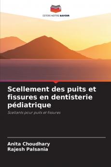 Scellement des puits et fissures en dentisterie pédiatrique