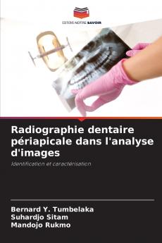 Radiographie dentaire périapicale dans l'analyse d'images
