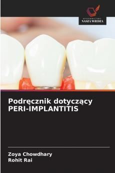 Podręcznik dotyczący PERI-IMPLANTITIS